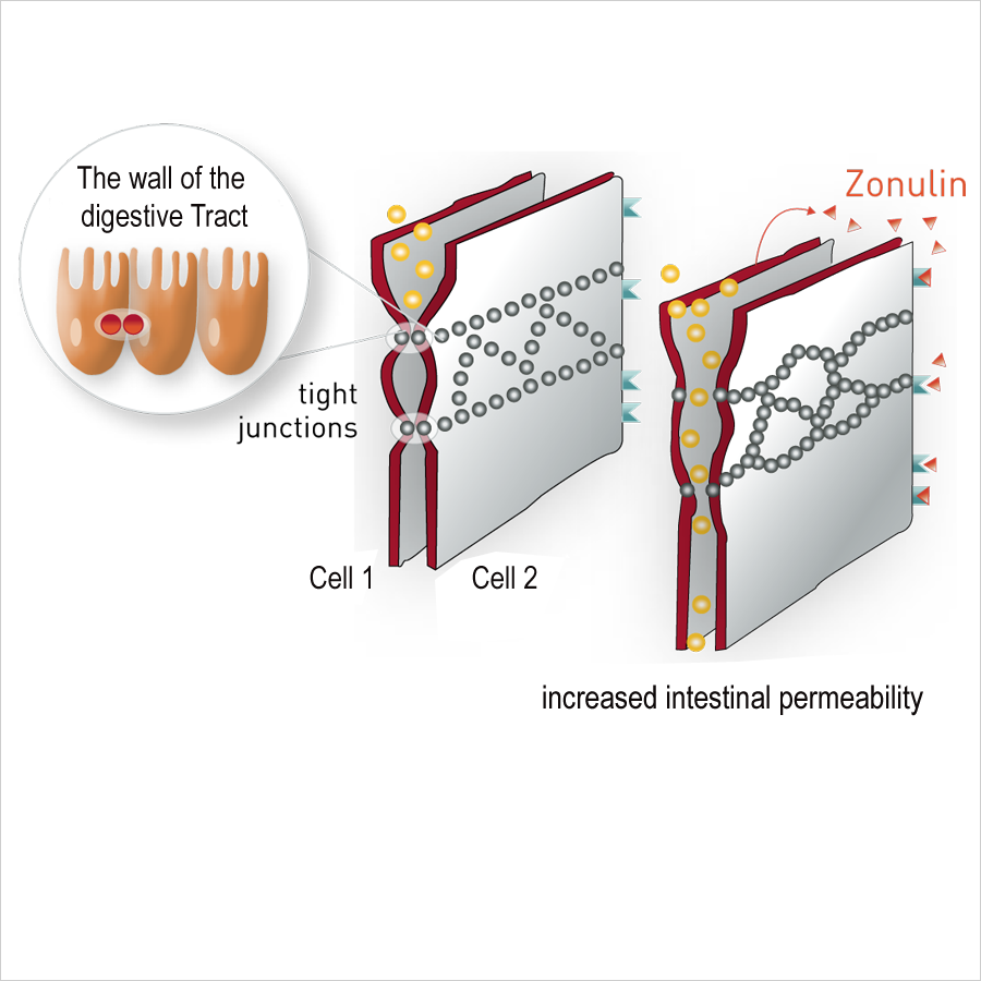 Zonulin-and-Zeolith-en